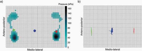 Figure 4. a) Example of instantaneous pressure map during quiet standing barefoot (pixel = 8.5 × 8.5 mm) with COP under the left foot (green triangle), under the right foot (red triangle), and global (blue circle). b) Example of COP displacement during quiet standing barefoot. The COP of interest is the global one (blue)