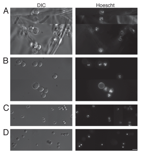 Figure 3 Accessory conidia are multinucleated prior to germination. Hoechst staining was performed on A. terreus accessory conidia, both attached (A) and detached (B) from the hyphae, and A. terreus PC (C) and A. fumigatus PC (D). DIC and UV images were captured by microscopy at 100x, and are representative of 3 experiments. Scale bars denote 10 µm.