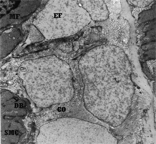 Figure 5.  Transmission electron micrograph of transitional zone of canine external carotid artery with more elastic fibres in comparison with the collagen fibres in extracellular space. EF, elastic fibres; COF, collagen fibres; SMC, smooth muscle cell; MF, myofilament; DB, dens bodies. Orcein stain, 8900×, Bar = 1.1 µm.