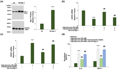 Figure 7. Overexpression of Egr-1 abolished the protective effects of Cabozantinib against high glucose in hGECs. Cells were transduced with Ad-viral Egr-1, followed by stimulation with high glucose (30 mM) with Cabozantinib (10 μM) for 24 hours. (a). Western blot analysis revealed successful overexpression of Egr-1; (b). mRNA of eNOS; (c). mRNA level of VEGF; (d). Secretions of IL-6 and MCP-1 (****, P < 0.0001 vs. Vehicle group; ##, P < 0.01 vs. high glucose group; $$, P < 0.01 vs. High glucose+Ad-Egr-1 group).