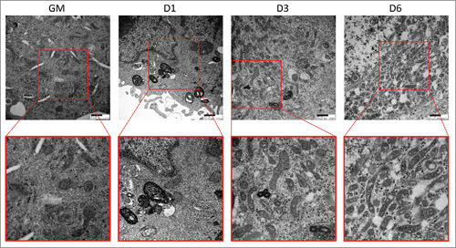 Figure 4. Electron micrographs of differentiating C2C12s. Transmission electron microscopy was performed on differentiating C2C12s to examine alterations in mitochondrial populations. Insets are presented at higher magnification below each original image. Scale bars: 500 nm. GM, growth medium.