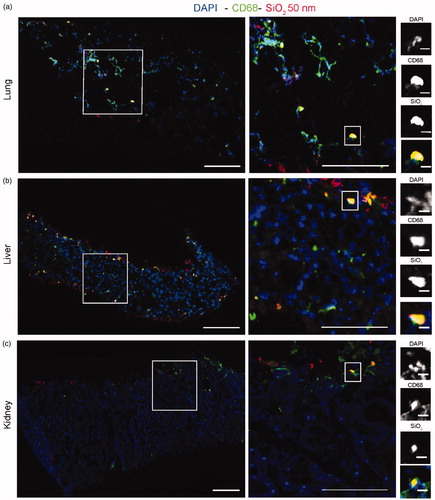 Figure 5. Confocal fluorescence images of murine lung (a), liver (b), and kidney (c) slices exposed to 50 nm SiO2 nanoparticles. Cross-sections were acquired by confocal fluorescence microscopy after exposure for 48 h to 25 μg/mL 50 nm red SiO2 nanoparticles in medium supplemented with 5% FBS. The indicated areas are shown at increased magnification to the right. For a and b, scale bars, from left: 200, 100, and 10 μm. For c, scale bars: 200 and 100 μm. Blue: DAPI-stained nuclei. Red: nanoparticles. Green: CD68-labeled macrophages (For interpretation of the references to colours in this legend, please refer to the web version of this article.). In slices exposed to SiO2 nanoparticles the results were comparable to what observed for the 40 nm PS-COOH, including higher uptake by the macrophages, however, uptake levels seemed overall lower, most probably due to the lower fluorescence intensity of these nanoparticles.
