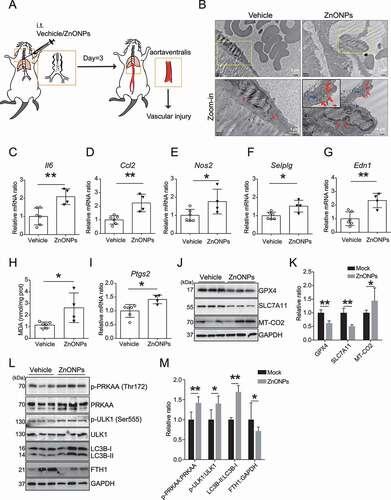 Figure 9. ZnONPs pulmonary exposure-induced vascular injury in mice was likely associated with ferritinophagy-mediated ferroptosis activation. (A) The experimental design of in vivo study. The detailed information was described in the Materials and Methods section. (B) Representative TEM images of mice vascular endothelial cells treated with vehicle or ZnONPs (12 μg/mice) for 3 d. Note that red arrows indicated either normal mitochondria (left panel) or aberrant mitochondria (right panel), blue arrows indicated autophagic vacuoles. Scale bar: 2 μm in the upper panel and scale bar: 1 μm in the bottom panel. (C–G) Relative mRNA expression levels of indicated cytokines in the blood vessels of mice treated with or without ZnONPs were determined. (H) The MDA contents in the vein of mice were determined. (I) Relative mRNA expression level of Ptgs2 in the vein of mice was determined. (J) The expression levels of GPX4, SLC7A11 and MT-CO2/COX2 in the blood vessels of mice were determined and the relative expression ratios were calculated in (K). (L) The expression levels of p-PRKAA, PRKAA, p-ULK1, ULK1, LC3B and FTH1 in the blood vessels of mice were determined and the relative expression ratios were calculated in (M). The data are representative of three experiments, and the values are expressed as the mean± S.D. *P < 0.05 and **P < 0.01