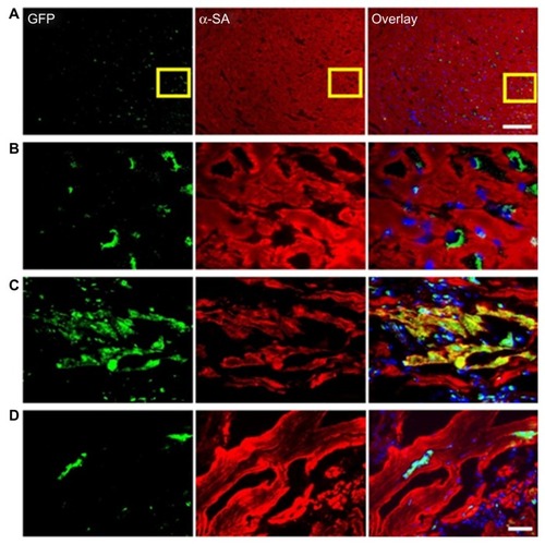 Figure 5 (A–D) Tracking of grafted cardiac stem cells (CSCs) by immunofluorescence. (A and B) CSCs within the recipient myocardium 3 days after injection shown at low and high magnification. (C and D) Transplanted CSCs can differentiate and integrate with host myocardium, as confirmed by green fluorescence protein (GFP) and α-sarcomeric actin (SA) double-staining. At day 14, CSCs could differentiate into cardiomyocytes, as confirmed by α-SA and GFP double-staining (C). However, this population became significantly decreased when the tissues were examined at day 28 (D), which is also consistent with the decrease in bioluminescence signals over this period. Scale bar = 100 μm (A), 20 μm (B–D).Reprinted from J Am Coll Cardiol. Li Z, Lee A, Huang M, et al. Imaging survival and function of transplanted cardiac resident stem cells.53:1229–1240. Copyright 2009 with permission from Elsevier.Citation102