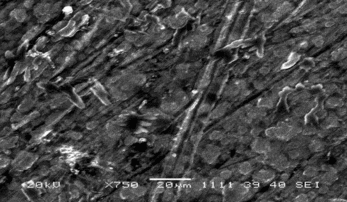 Figure 3 SEM of Pt/polypyrrole-ferrocenium-uricase-gelatine.