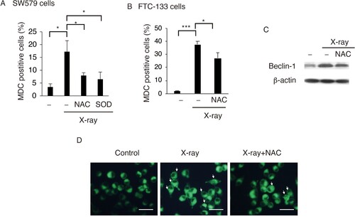 Figure 3. ROS promotes X-ray-induced autophagy in TC cells. NAC or SOD reduced X-ray-induced autophagy in SW579 cells (A) and FTC-113 cells (B), as measured by FACS with MDC staining. Results are expressed as mean ± SD (n = 3). *P < 0.05, ***P < 0.001. (C) NAC reduced X-ray-induced Beclin-1 expression in SW579 cells, as analyzed by western blot. (D) Autophagic vacuoles were visualized by MDC staining in SW579 cells at 24 h post-irradiation. Representative photos are shown.