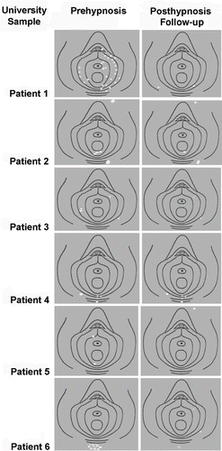 Figure 1. Physicians diagrams for the university sample shown reverse contrast for printability.
