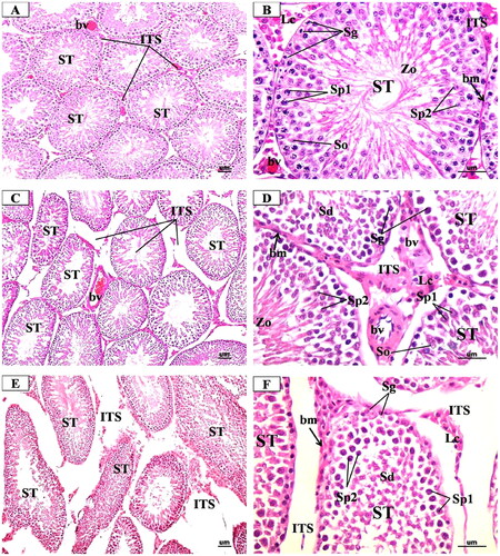 Figure 5. Representative Photomicrographs of H&E-stained transverse sections of the testis from (A & B) Control group showing normal structure of the seminiferous tubules (ST) surrounded by regular thin basement membrane (bm) with spermatozoa (Zo) filled lumina and narrow interstitial spaces (ITS) between the tubules containing little connective tissue and blood vessels (bv). high magnification of ST showed regularly arranged spermatogenic cords formed of spermatogonia (g), primary spermatocytes (Sp1), secondary spermatocytes (Sp2), spermatids (Sd) and Sertoli cells (so). (C & D) low dose MgO NPs group showing few changes s compared to the control group where the seminiferous tubules (ST) were slightly separated with the presence of dilated and congested blood vessels (bv). high magnification showed some seminiferous tubules (ST) appeared nearly normal appearance of spermatogenic cells. Other tubules showed little irregularly arranged spermatogenic cords and slight thickening of basement membrane (bm). (E & F) High dose MgO NPs group showing disorganised, irregular shapes seminiferous tubules (ST), which appeared atrophic and widely separated with irregular thick basement membrane (bm). high magnification showed degenerated spermatogenic cells and lumina devoid of spermatozoa. The interstitial tissue (is wide and contained few degenerated Leydig cells (Lc). (A, C, E X 200- B, D, F X 400).