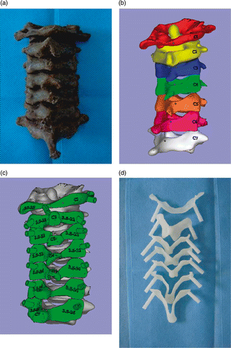 Figure 4. (a) Cervical spine specimen. (b) 3D reconstruction of cervical spine. (c) Drill template and corresponding cervical vertebrae. (d) Physical biomodel of the navigational template from C1–C7.