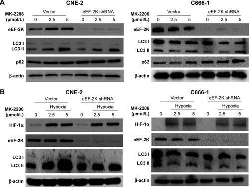 Figure 2 AKT inhibition induced eEF-2 kinase-dependent autophagy.Notes: (A) CNE-2 and C666-1 cells were transfected with a nontargeting RNA (Vector) or an shRNA targeting eEF-2 kinase (eEF-2K shRNA), followed by treatment with MK-2206 for 24 hours. eEF-2 kinase, LC3 and p62 were examined by Western blotting. β-Actin was used as a loading control. (B) CNE-2 and C666-1 cells were transfected with a nontargeting RNA or an eEF-2 kinase-targeted shRNA, followed by treatment with MK-2206 for 24 hours under hypoxia (1% O2). HIF-1α, eEF-2 kinase and LC3 were examined by Western blotting. β-Actin was used as a loading control.