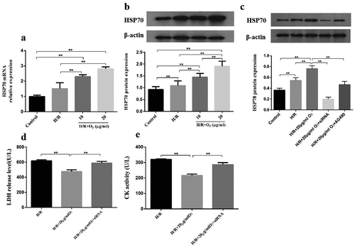 Figure 4. The effect of ozone mediated by HSP70 to Cardiomyocytes Injury induced by I/R. (a) The relative expression of HSP70 mRNA was detected by RT-PCR. (b) The protein level of HSP70 was assayed by Western blot. (c) Cardiomyocytes were transfected by HSP70 siRNA, control or pretreated with AG-490 followed by 20 μg/ml ozone treatment and I/R treatment. HSP70 protein level was determined. LDH release level (d) and CK activity (e) in Cardiomyocytes were detected. n = 3 per group, **p < 0.01