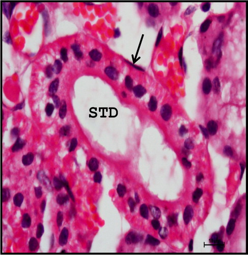 Figure 22. Photomicrograph of neonatal buffalo showing dark basophilic myoepithelial cell (arrow) lining the striated duct (STD) of the mandibular gland. Haematoxylin and Eosin method ×1000.
