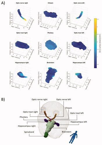 Figure 3. Surface maps of the inter-observer variability given as the mean standard deviation (SD) across the 13 patients are shown in (A). Anatomical directions are illustrated in (B). Due to large variation in the caudal end of the spinal cord maps for the spinal cord is not shown. Individual animated maps can be found in Supplementary figures 1–10.