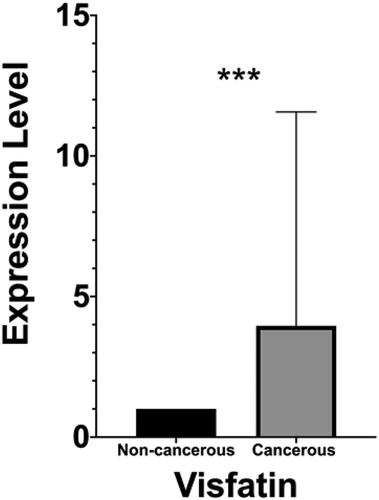Figure 1. Visfatin expression levels analysis in colon cancerous tissue and paired adjacent non-cancerous tissue. To calculate the difference, non-parametric Wilcoxon matched pairs signed rank test was used. ***, highly significant.