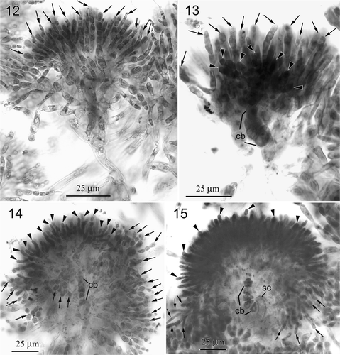 Figs 12–15. Neoizziella asiatica, gen. et sp. nov. Figs 12, 13. Two views of a young carposporophyte. 12. Focal plane of the involucral filaments (arrows), which surround the gonimoblasts completely. 13. Focal plane of distinct carpogonial branch (cb), the gonimoblasts (arrowheads) and the rear involucral filaments (arrows). 14. Nearly mature carposporophyte showing the gonimoblasts (arrowheads) intermingling with involucral filaments (arrows). Note that the cells of carpogonial branch (cb) are not fused. 15. Fully developed gonimoblasts bearing terminal, mature carposporangia (arrowheads). Note that the cells of carpogonial branch (cb) and the supporting cell (sc) remain distinct.