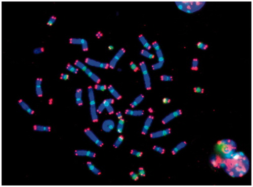 Figure 4. Detection of unstable chromosome aberrations after telomere (red; fluorescence staining at the ends of the chromosomes) and centromere (green; fluorescence staining at the centre of the chromosomes) staining. A dicentric chromosome corresponds to two green centromere signals and four red telomere signals at the ends of the chromosome. A chromosome ring corresponds to a circular chromosome with a green centromere signal and without red telomere signals. An acentric chromosome corresponds to a chromosome fragment without a green centromere signal with or without red telomere signals.