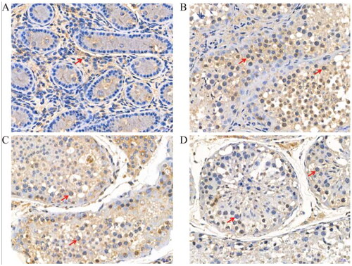 Figure 3. Immunohistochemical staining of LYZL4 protein at different developmental stages of yak testes (400×); (A) 6 months of Ashidan yak; (B) 18 months of Ashidan yak; (C) 30 months of Ashidan yak; (D) 72 months of Ashidan yak.