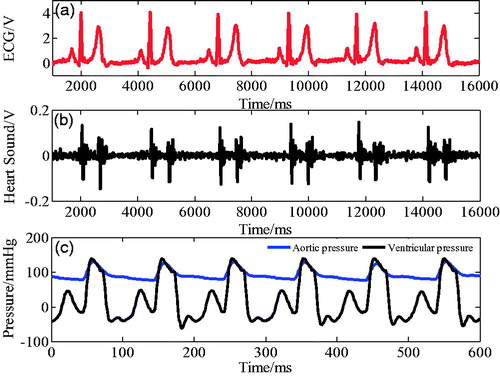 Figure 13. Synchronized ECG signal, heart sound, and corresponding ventricular pressure.