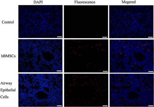 Figure 4. Transplantation of hBMMSCs, hBMMSCs-derived n airway epithelial cells resulted in mouse acute lung injury. To test whether transplantation of airway epithelial cells and hBMSCs taken part in recovery of pulmonary alveolus, paraffin section was used to observed the location for transplantation of airway epithelial cells in scathing lung tissue. Human nuclei protein was used as a label to discover the hBMSCs or hBMSCs-derived airway epithelial cells in tissue of pulmonary alveolus. The results showed that the human cells were found in mouse lung tissue through tail vein injection, but the group of type II pneumocytes was significantly higher than group of hBMSCs. (bar = 100 μm).