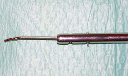 Figure 3. The photograph demonstrates how a ball-tipped guide wire is passed through the nail. A 3.5-mm screw is placed in one of the distal holes which will lock the guide wire during extraction.
