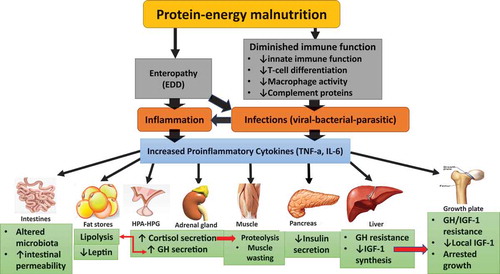 Figure 1. Malnutrition, infection, and inflammation interactions