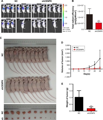 Figure 3 Silencing of CENPK suppresses HCC tumor growth in vivo.Notes: (A) Representative bioluminescence images (n=10). (B) Fluorescence intensity of GFP was weaker in the BEL-7404-shCENPK group than in the BEL-7404-shNC group. (C) Transduced BEL-7404 cells were subcutaneously injected into nude mice (n=10). (D and E) After 24 days, the mice were euthanized, and the tumors were excised. Representative tumors are shown: (D) tumor growth curve and (E) tumor weight. ***P<0.001.Abbreviations: HCC, hepatocellular carcinoma; GFP, green fluorescent protein; NC, negative control.