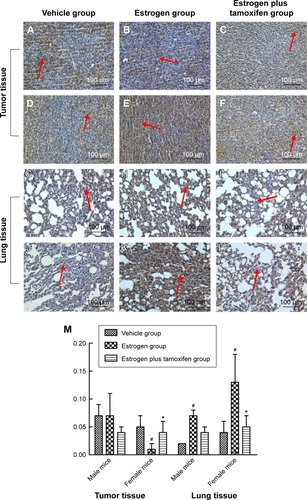 Figure 7 Protein immunohistochemical results of ERβ in mice tumor tissue and lung tissue; 400× magnification.