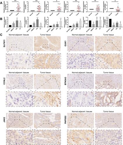 Figure 9 (A)Relative expression levels of the 6 autophagy-immune-related genes in the prognosis model in 22 paired BLCA and matched adjacent normal bladder tissues were examined by qRT-PCR. (B) Relative expression levels of 6 autophagy-immune-related genes in the prognosis model in normal bladder cell (SV-HUC-1) and bladder cancer cells (UMUC3, T24, EJ). (C) Representative images of immunohistochemistry of 6 autophagy-immune-related genes in BLCA tissues compared to adjacent normal bladder tissues. *p < 0.05; **p < 0.01; ***p < 0.001.