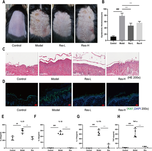 Figure 2 Res improves IMQ-induced psoriasis-like skin inflammation.