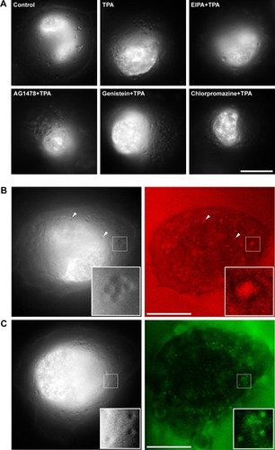 Figure 2 Establishment of real-time imaging of macropinocytosis based on super-resolution structured illumination microscopy.Notes: K-rasG12C MIA PaCa-2 cell nuclei were dyed by Hoechst 33342 after FBS starving for 18 hours. (A) Cells were treated with 0.1 µM TPA for 10 minutes after pretreatment for 30 minutes, while the control group was not treated with any inhibitor, including 100 µM EIPA (macropinocytosis inhibitor), 25 µM chlorpromazine (clathrin-dependent endocytosis inhibitor), 100 µM genistein (lipid raft-mediated endocytosis inhibitor), and 100 nM AG1478 (EGFR tyrosine kinase inhibitor). (B) Cells were treated with 20 µg/mL dextran, AlexaFluor 488 for 5 minutes. (C) Cells were treated with 20 µg/mL BSA, AlexaFluor 568 for 5 minutes. Arrowheads showed that the co-localization between cups and Dextrann. Bars, 10 µm.Abbreviations: BSA, bovine serum albumin; FBS, fetal bovine serum; EIPA, 5-(N-ethyl-N-isopropyl)-amiloride.