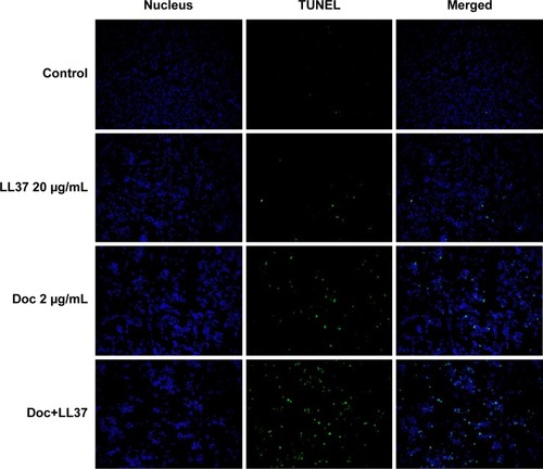 Figure 7 TUNEL staining confirmed the induction of DNA fragmentation by LL37 (20 µg/mL), Doc (2 µg/mL) and Doc+LL37 (2 µg/mL +20 µg/mL) in HCT116 (24 hours).Abbreviations: TUNEL, terminal deoxynucleotidyl transferase deoxyuridine triphosphate nick-end labeling; Doc, docetaxel.