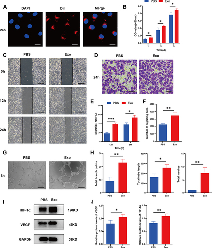 Figure 3 Internalization of hASC-Exos by HUVECs promotes their angiogenic activities. (A) Representative fluorescence micrograph of Dil (red)-labeled hASC-Exos internalized by HUVECs. Nuclei were stained blue with DAPI. Scale bar: 25 μm. (B) CCK-8 assay for proliferation of HUVECs cultured with hASC-Exos on days 1, 3, and 5. (C) Scratch assay of HUVECs cultured with hASC-Exos. Scale bar: 400 μm. (D) Transwell assay of HUVECs cultured with hASC-Exos. Scale bar: 100 μm. Quantitative analysis of (E) scratch assay and (F) transwell assay. (G) Tube formation assay of HUVECs cultured with hASC-Exos. Scale bar: 200 μm. (H) Quantitative analysis (total meshes, branch points, and tube length) of HUVECs cultured with hASC-Exos. (I) Western blot assay and (J) Quantitative analysis (HIF-1α, VEGF) for HUVECs cultured with hASCs-Exos. Data are presented as the mean ± SD of three replicates. *p < 0.05, **p < 0.01, ***p < 0.001.