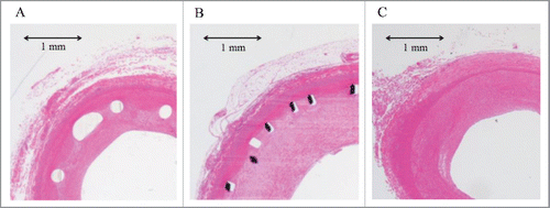 FIGURE 4. Representative photomicrographs of hematoxylin-eosin-stained sections of the porcine iliac arteries 6 weeks after stent implantation. (A) Igaki-Tamai stent. (B) Bare metal stent. (C) Non-stented segment.
