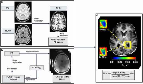 Figure 3. Image processing. (a) Brain-extracted high-resolution T1-w GRE and FLAIR images were bias field corrected, co-registered and brought into PD space. (b) Dynamic FLASH volumes were first registered to the image at the temporal center of the acquisition. In a second step, this skull-stripped, bias-corrected image was registered to the PD image and the transform applied to each volume in the FLASH series. (c) A representative R1(t) map, prepared by fitting dynamic FLASH volumes to the GRE signal intensity equation (shown in rectangle). Insets: R1 maps of the posterior horn (outlined in yellow) before (upper) and 52 seconds after (lower) CA injection. CP-containing voxels show a clear R1 increase after CA arrival.