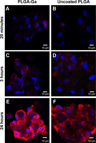 Figure S3 Favored intake of coated nanoparticles by HepaRG cells seen with Zeiss LSM710 confocal microscope with fixed optical parameters after 20 minutes (A, B), 3 hours (C, D) or 24 hours (E, F) of in vitro incubation of coated PLGA-Ga nanoparticles (A, C, E) or uncoated PLGA nanoparticles (B, D, F).Notes: Fixed cells were imaged on a Zeiss confocal LSM710 microscope. Images were acquired using the 63× objective in oil, as 12-bit images. To image DilC18, DsRed filters were used and the Zeiss confocal LSM710 microscope was set as follows: masgain =600; digital gain =1.0; laser line (561 nm): 15%. Cell nuclei were stained with 4′,6-diamidino-2-phenylindole (DAPI). Master gain =600; digital gain =1.0; laser line (561 nm): 15%.Abbreviations: PLGA, poly(lactic-co-glycolic) acid; PLGA-Ga, PLGA nanoparticles functionalized with galactosamine.