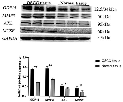 Figure 10. Western blot of key proteins in OSCC nude mouse. The expression level of GDF15, MCSF, I309, MMP3, CTACK and AXL was detected by western blotting and its quantification in OSCC nude mouse tumor tissue and normal tissue