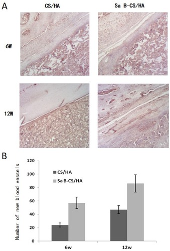 Figure 12 Results of immunohistochemistry conducted at decalcified samples.Notes: (A) Representative images of immunohistochemical staining of CD34. (B) CD34 was found expressed in vascular endothelial cell, with significant increases in both the size and area of vessels in Group Sa B-CS/HA compared with Group CS/HA (p<0.05).