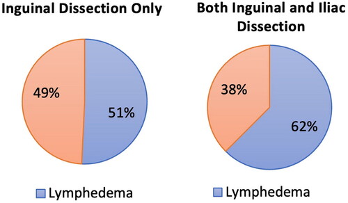 Figure 2. A Pie graph showing the incidences of lymphedema in patients who received inguinal LND only and those who received both inguinal and iliac LND.