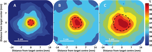 Figure 7. Representative examples of time-averaged spatial temperature distributions for 4 mm, 8 mm, and 12 mm treatment cells in vivo (coronal plane). The treatment cell is outlined in black dashed line.