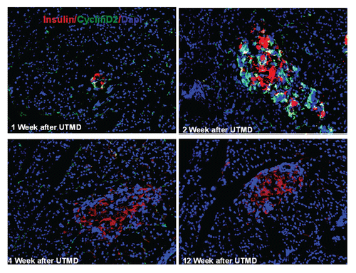 Figure 4 Transient transgenic expression of human cyclin D2 in rat pancreas. Upper left: rat pancreas of RIP-cyclin D2/CDK4/GLP1 treated group one week after UTMD; Upper right: two weeks after UTMD; Lower left: 4 weeks after UTMD; Lower right: 12 weeks after UTMD; x200 magnification.