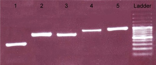 Figure 2 Agarose gel electrophoresis of PCR product. The presence of PCR products was confirmed by analyzing the products on a 2% agarose gel. From left: lane 1: exon 1 (405 bp), lane 2: exon 1–2 (737 bp), lane 3: exon 2*–4 (706 bp), lane 4: exon 5–7* (860 bp), lane 5: exon 7–8 (916 bp), lane 6: DNA ladder (Thermo Scientific Gene Ruler 100 bp #SM0241/2/3).