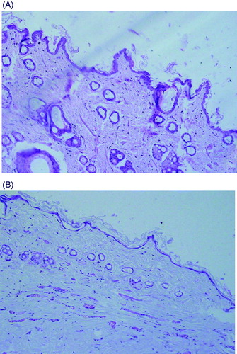 Figure 3. Observation of tissue slices of rats’ abdominal skin (×200). A) Normal rat, B) DM rat.