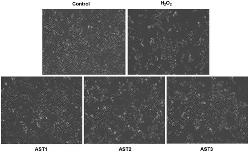 Figure 2. Effect of AST on the morphology of ARPE-19 cells treated with H2O2. Control group, non-treated cells. H2O2 group, cells treated with 200 µmol/L H2O2 for 24 h. AST1 group, cells treated with 40 µg/L AST for 1 h, and then cultured for another 24 h after addition of 200 µmol/L H2O2. AST2 group, cells treated with 40 µg/L AST and 200 µmol/L H2O2 for 24 h. AST3 group, cells first treated with 200 µmol/L H2O2 for 1 h, and then cultured for another 24 h after addition of 40 µg/L AST. Note: Morphological changes under an inverted fluorescence microscope (×200).