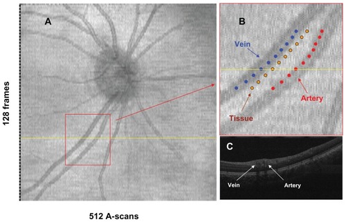 Figure 1 OCT images obtained with SL-UHR-OCT. An OCT fundus image that was reconstructed from an OCT dataset (A). The identified vein, artery and tissue were shown on the enlarged fundus image (B); ten fringe images at the locations with marked dots were sampled from the artery, vein and tissue to calculate the optical densities. OCT B-scan image (C) across the sampled range was from the scan marked with the yellow line in image A.