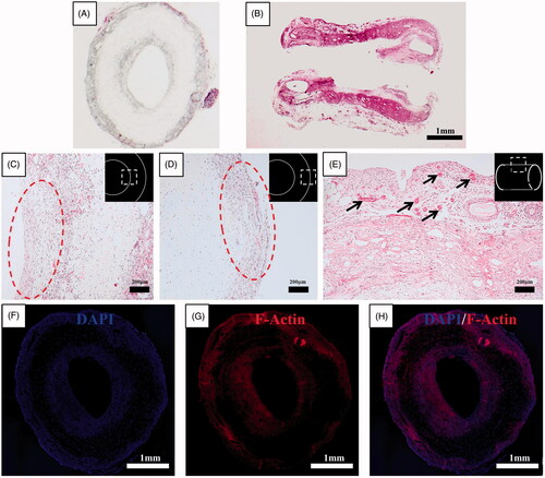 Figure 6. Histological results for the haematoxylin-eosin–stained axial (A) and longitudinal (B) section of omentum-cultured scaffold. The scaffold material was integrated into the omentum, and a mixture of inflammatory cells and fibroblasts infiltrated inside and outside of the scaffold. The host cells were aligned with the cylindrical direction inside (C) and outside (D) of the scaffold. (E) Several newly developed blood vessels in the outer side of the scaffold revealed the tissue regeneration process. Immunohistochemistry of omentum-cultured scaffold. DAPI (4,6-diamidino-2-phenylindole) staining (F). Rhodamine phalloidin staining for F-actin (G). The merged file of DAPI (4,6-diamidino-2-phenylindole)/F-Actin (H) indicated that the host cells infiltrated into the scaffold and along the inner/outer wall of the scaffold.