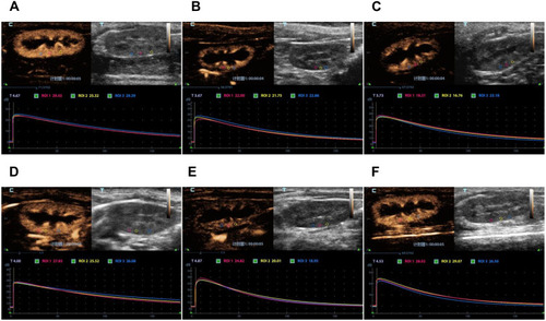 Figure 7 Contrast-Enhanced Ultrasound images. Perfusion of renal vessels, cortex and medulla and time intensity curve about the ROI. The perfusion in CLP group was weaker than that in CLP+Cur group from a macro view. (A) Sham group at 12h. (B) CLP group at 12h. (C) CLP+Cur at 12h. (D) Sham group at 24h. (E) CLP group at 24h. (F) CLP+Cur at 24h.