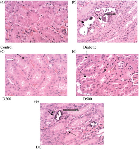 Figure 4. Histopathological changes (× 400) in kidney of control and alloxan-induced diabetic rats. Control: normal renal corpuscle and tubules. Diabetic: cellular degeneration and swelling (black arrow), glomerular atrophy and widening of Bowman's space (white arrow). D200: mild cellular degeneration (black arrow) and congestion (white arrow). D500: mild atrophy and accumulation of protein in glomerular spaces (black arrow). DG: mild cellular degeneration (black arrow) and fatty changes in glomerular epithelia (white arrow).