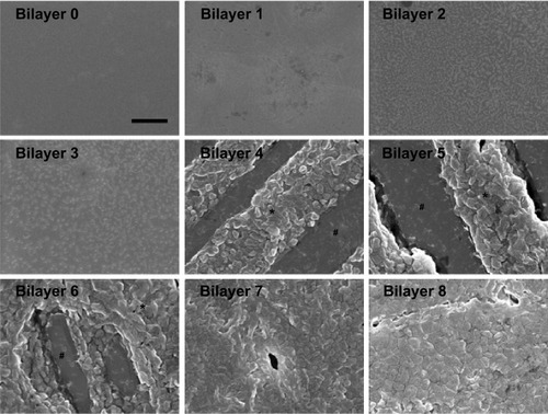 Figure 4 Scanning electron microscope observation of each bilayer.Notes: Scale bar =1 μm. “*” and “#” represent chitosan/siRNA nanoparticles and sodium hyaluranate, respectively.