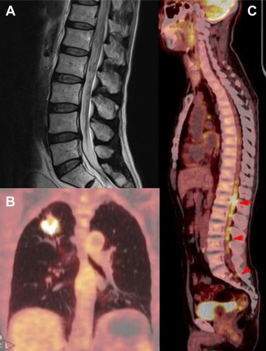 Figure 1 MRI and PET images.