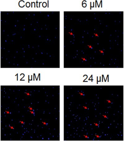 Figure 2. Heptazoline alters the nuclear morphology of SCC-15 cells. Analysis of the nuclear morphology of the heptazoline-treated SCC-15 cells by DAPI staining. Experiments were done in triplicate.